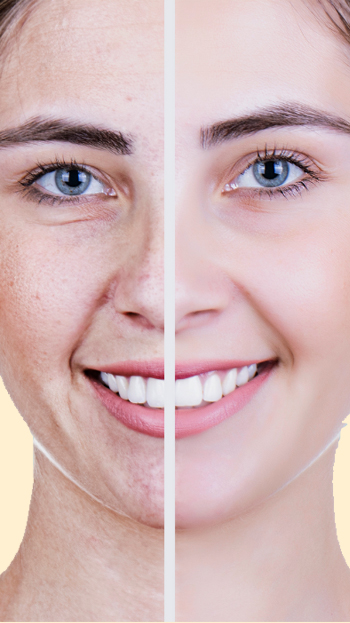 Anti Ageing